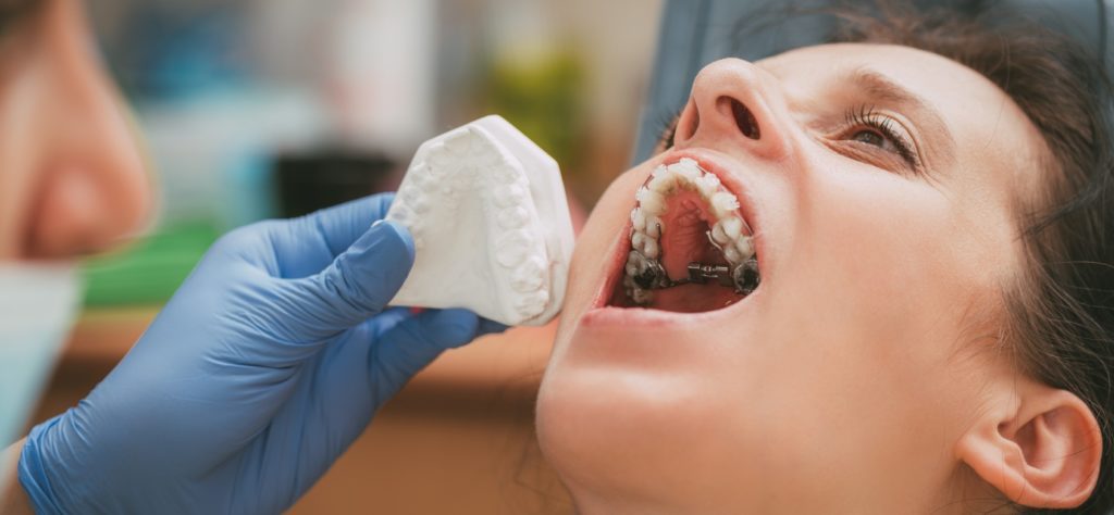 mutuelle orthodontie et consultation orthodontiste