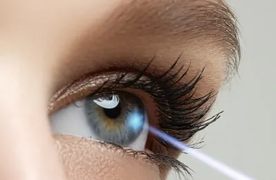 Le remboursement de la chirurgie des yeux au laser