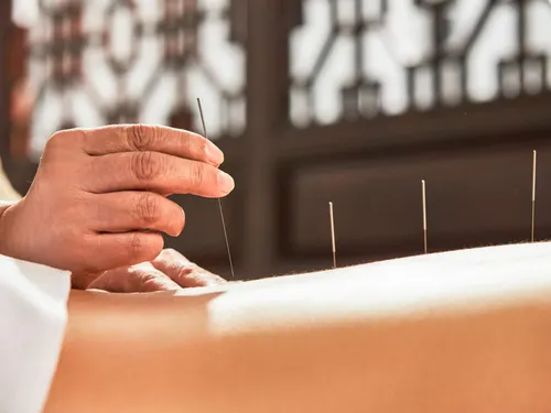 La mutuelle rembourse-t-elle l&#039;acupuncteur ?