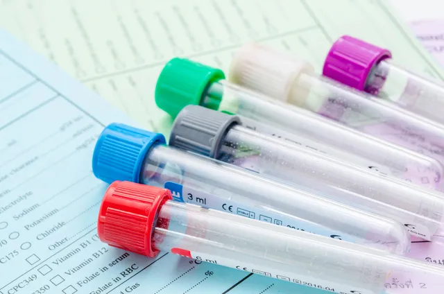 Cadmium : un test de dépistage remboursé dès le 16 juin 2026, qui est concerné ?